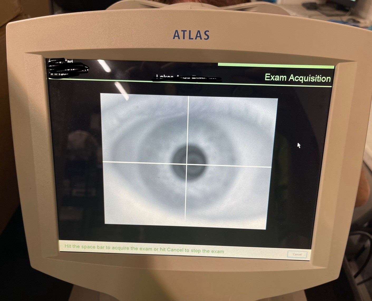 Zeiss Atlas 9000 Corneal Topographer System w/ Windows XP