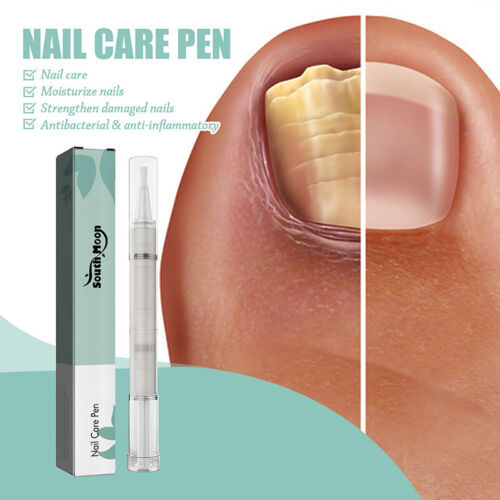 Anti Fungal Nail Treatment Repair Finger Toe Care Nail Fungus Liquid Pen-NE W - Picture 1 of 13