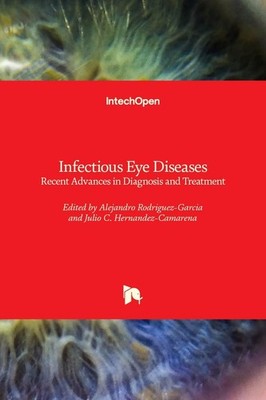 Infectious Eye Diseases: Recent Advances in Diagnosis and Treatment by Alejandro