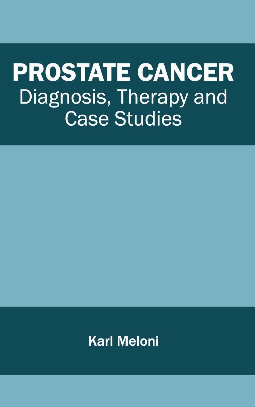 Thumbnail - Karl Meloni | Prostate Cancer | Buch | Englisch (2015) | Ean