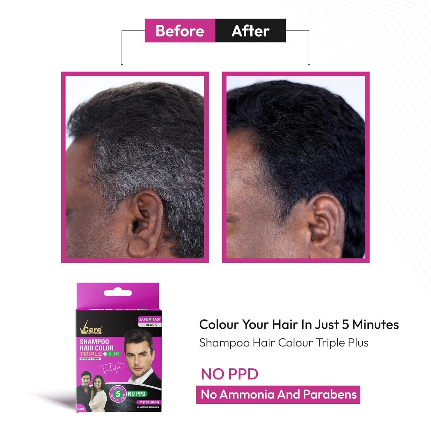 - 15ml Black Color And Deeply Nourishes Your Hair| 5 Mi