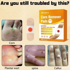 10Pc Natural Plantar Wart & Corn Remover Treatment for Feet Toes & Finger Pastes