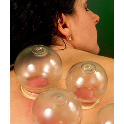 NEW! 12pcs FIRE CUPPING JAR SET MASSAGE ACUPUNTURE VACUUM GLASS
