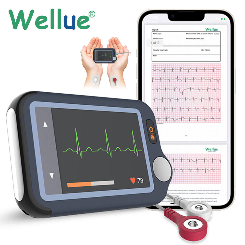 Mobile EKG Gerät mit kostenloser APP und PC-Software Professioneller EKG-Bericht