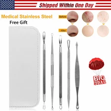 Blemish Blackhead Remover 5 Piece Set Extractor Tools Pimple Removal Kit White