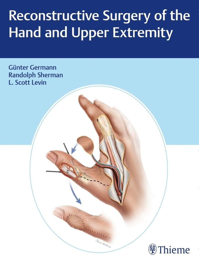 Thumbnail - Reconstructive Surgery Of The Hand And Upper Extremity With Bonus