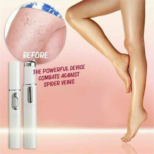 Blue Light Therapy Varicose Veins Pen - Soft Scar Wrinkle Removal New - Picture 1 of 12