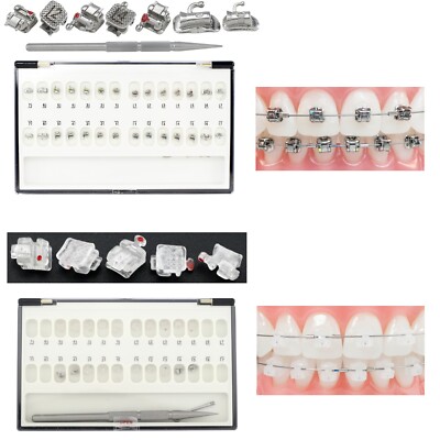 Orthodontic Self Ligating Bracket Metal Ceramic Clear Roth 022 345 Ormco Damon Q
