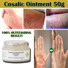 Deep Moisturizing Ointment - 2% Coal Tar Stops Psoriasis 1.7 Oz