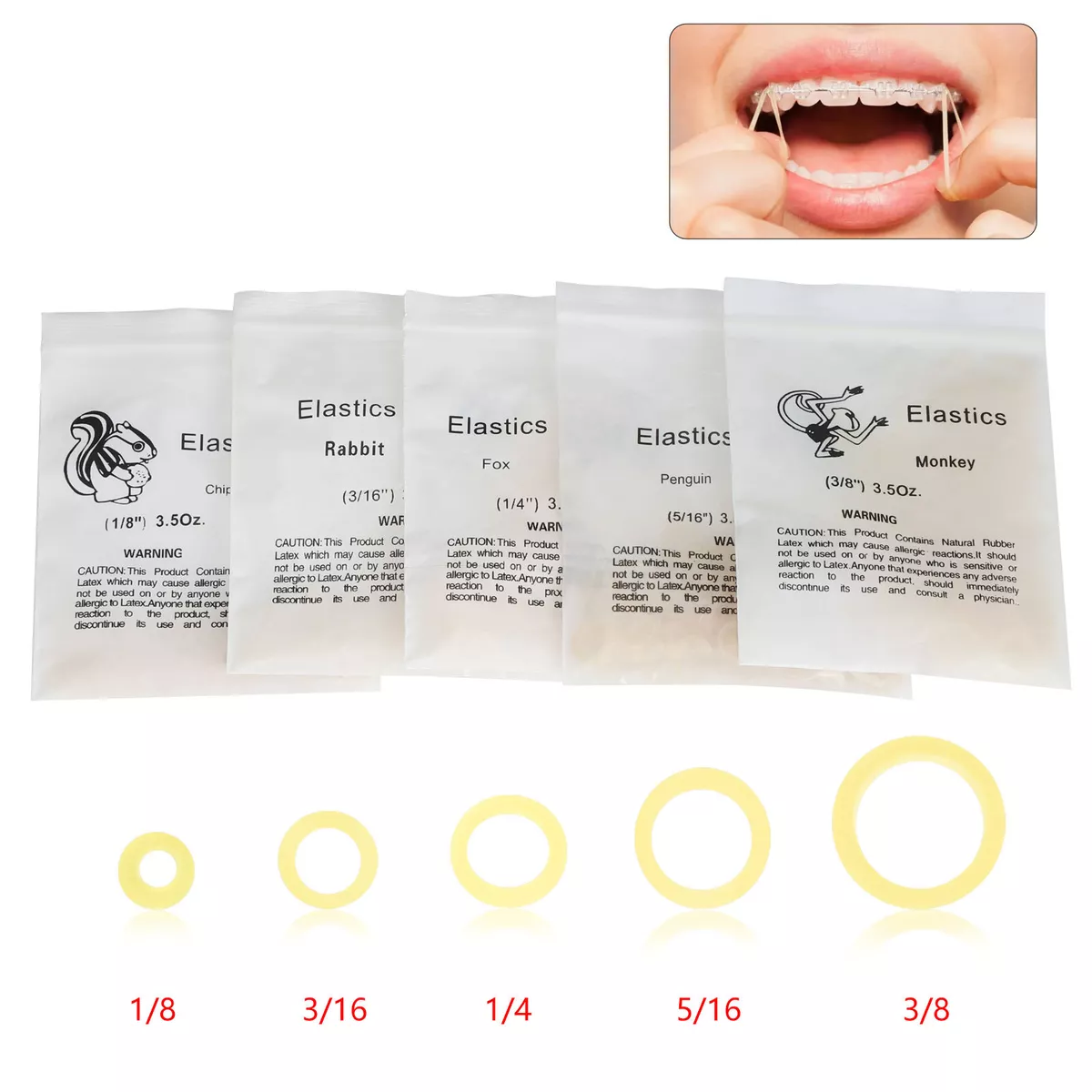 Where can i buy rubber bands for braces outlet