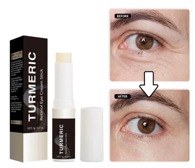 Turmeric Retinol Eye Cream Stick Anti-Ageing Dark Circles Puffiness Wrinkle Care
