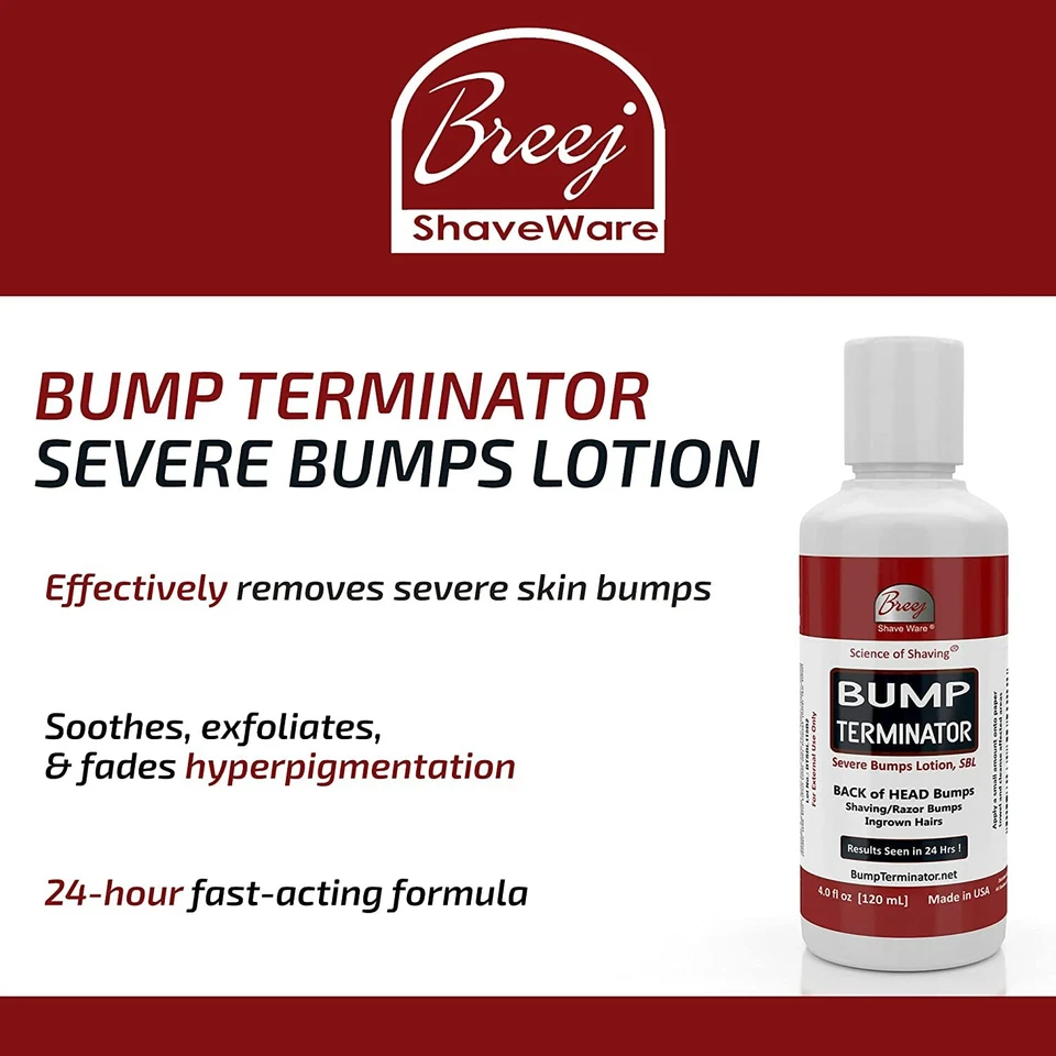Loção Bump Terminator Severe Bumps - Tratamento de cabelo encravado para barbear - Unissex - Imagem 2 de 4