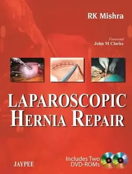 Laparoscopic Hernia Repair | Rk Mishra | Englisch | Buch | Gebunden | 2013-image