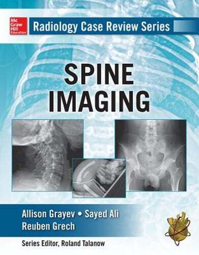 Radiology Case Review Series: Spine by Allison Michele Grayev: New