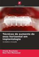 TéCnicas De Aumento Do Osso Horizontal Em Implantologia Nour Ben Messaoud