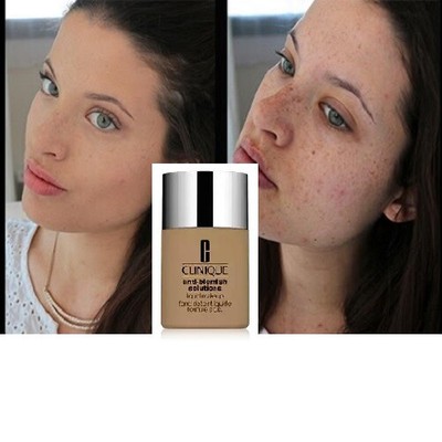clinique anti blemish liquid makeup