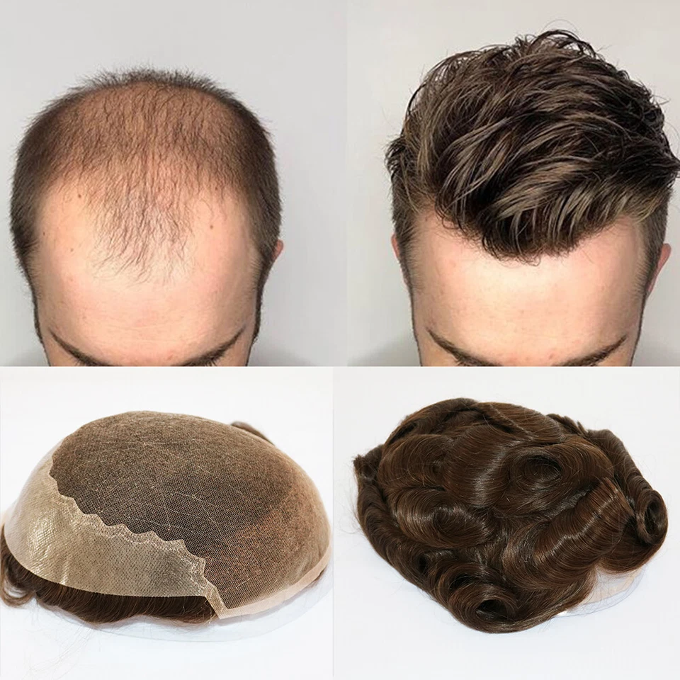Male Hair Prosthesis Lace Front & Pu Back Natural Hairline Toupee Men Wig Units - Image 4 of 4