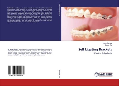 Self Ligating Brackets Neha Rathore
