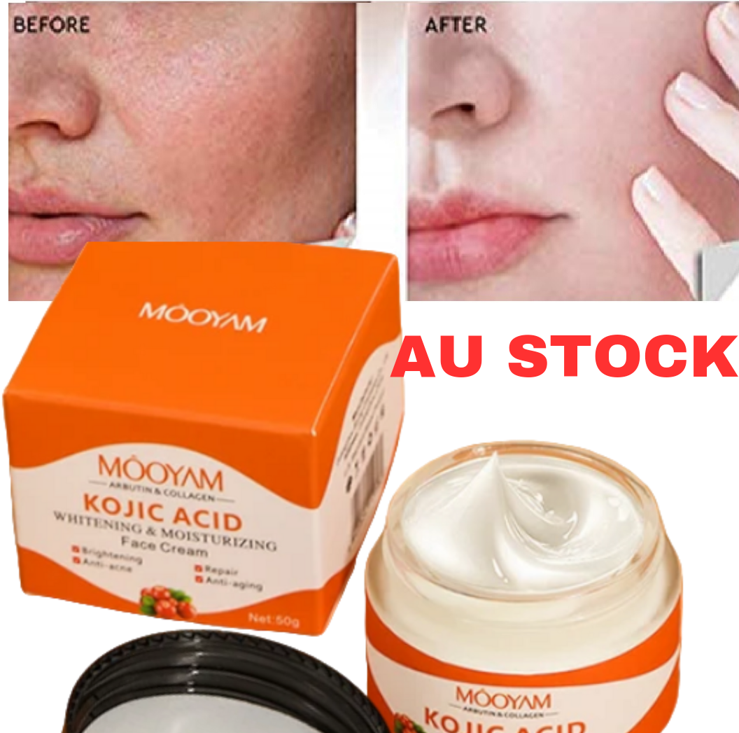 KOJIC Acid Facial Cream Lightening Whitening Skin Pigmentation Dark spots  50ml