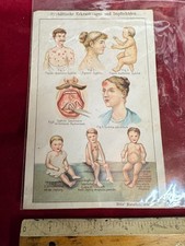 Syphillis Syphilis medical page showing symptoms C19th ??