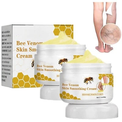 Bienengift Krampfadern Creme 60G 2 Stk Furzero Bienengiftsalbe Gegen Besenreiser