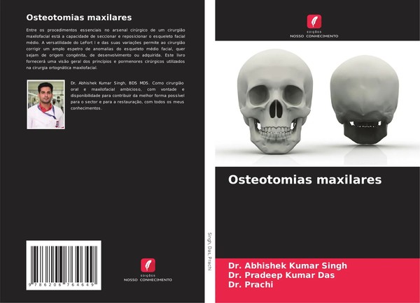 Osteotomias Maxilares Abhishek Kumar Singh (U. A.) Taschenbuch Portugiesisch-image