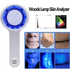 New Skin Analyzer Portable Facial Salon Beauty Analyzer UV Lamp Wood Dermatology