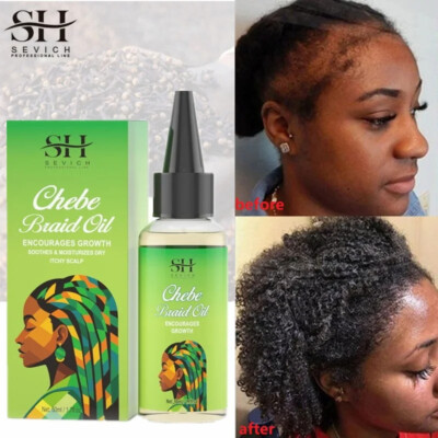 Sevich Chebe Haarwachstumsserum Afrika Traktion Alopezie Chebe Anti Haarausfall