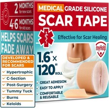 Medical Grade Silicone Scar Tape - 1.6 x120 - Visible Difference on Surgical...