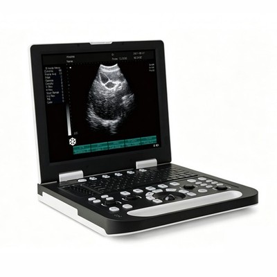 Full Digital Laptop Color Doppler Ultrasound Scanner for Doctor & Clinic