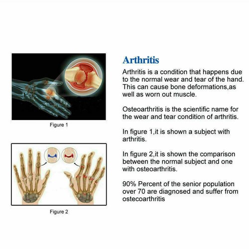 Arthritis Compression Gloves For Rheumatoid Osteoarthritis Raynaud's Pain Relie - Picture 2 of 18