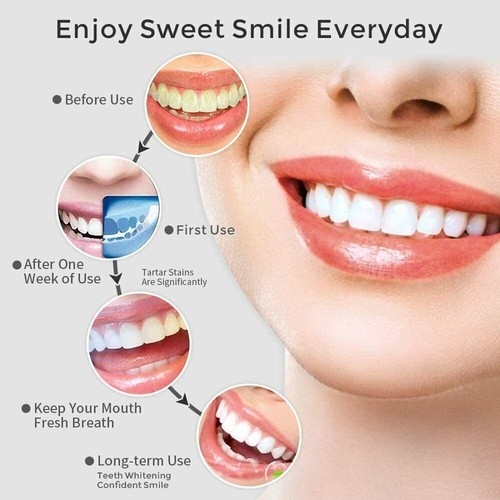 Water Cordless Flosser Dental Oral Irrigator Floss Teeth Cleaner 8 Jet Tips - Picture 7 of 14