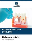 Mahendra Mohan Katiyar (U. A.) | Zahnimplantate | Taschenbuch | Deutsch (2025)