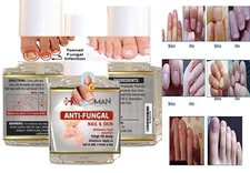 HONGO quick Best nail Fungal support FAST BEST PRODUCT athletes foot NAILS zana