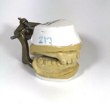 Full Mouth Teeth Mold Metal Jaw Dentures Impressions Oddity Macabre Halloween