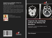 Impacto Da Realidade Virtual Na DoençA De Meniere ThéO Dosquet