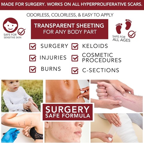 Advanced Crosspolymer Silicone Scar Gel Sheeting - Reduction for Surgery & Burns - Picture 6 of 7