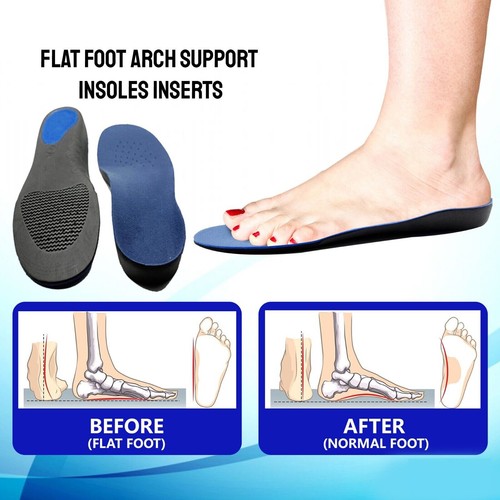 3D Orthotic Shoe Insoles for Arch Support Plantar Fasciitis Flat Feet Heel Pain - 第 7/15 張圖片