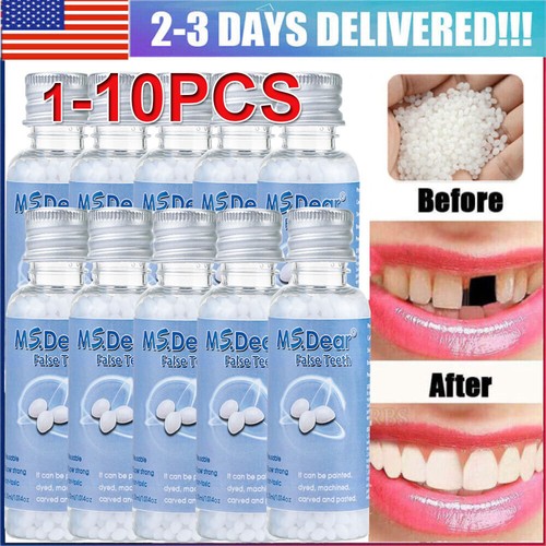 8x Tooth Repair Kit - Temporary Teeth Replacement Kit for Missing & Broken Teeth