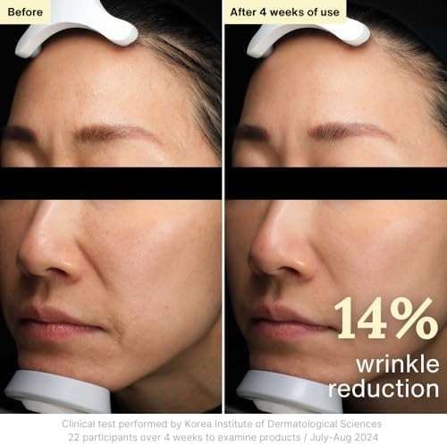 Rothea Resilience Cream - Face and Neck Cream, Moisturizer, Anti-Aging with Bak - Bild 4 von 7
