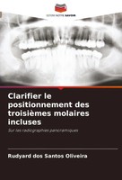 Clarifier Le Positionnement Des TroisièMes Molaires Incluses Oliveira Buch 2024