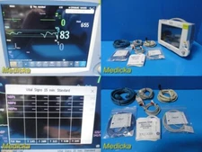 2014 Philips Intellivue MP30 Patient Monitor W/ MMS Module M3001A, Leads ~ 29776