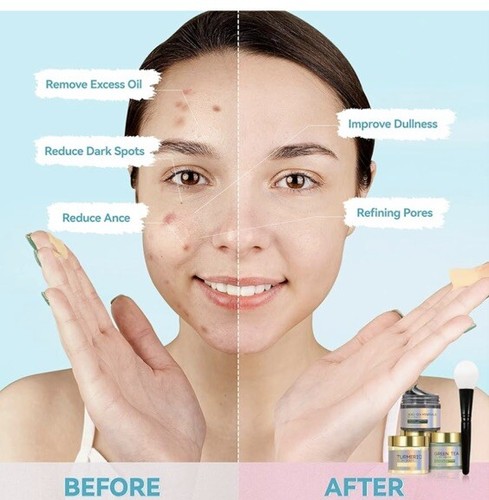 Anti Acne Spa Facial Mask….Green Tea, Turmeric, Dead Sea Mineral Masks…Sealed - Picture 6 of 8