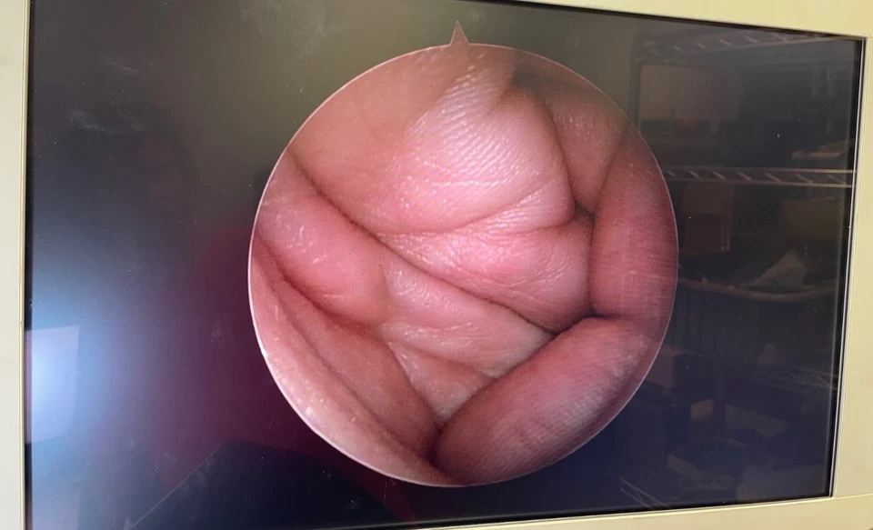 Conmed Linvatec T2930 Autoclavable Arthroscope Set w/ Hardware Light Cord & Case - Image 2 of 4