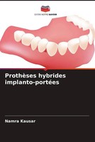 Namra Kausar | ProthèSes Hybrides Implanto-PortéEs | Taschenbuch | FranzöSisch