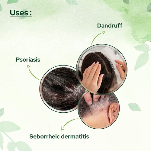 Cosalic Coal Tar & Salicylic Acid Shampoo 200ml (6.76oz) | Scalp Treatment - Picture 3 of 6