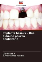 Lizy Teena A (U. A.) | Implants Basaux - Une Aubaine Pour La Dentisterie | Buch