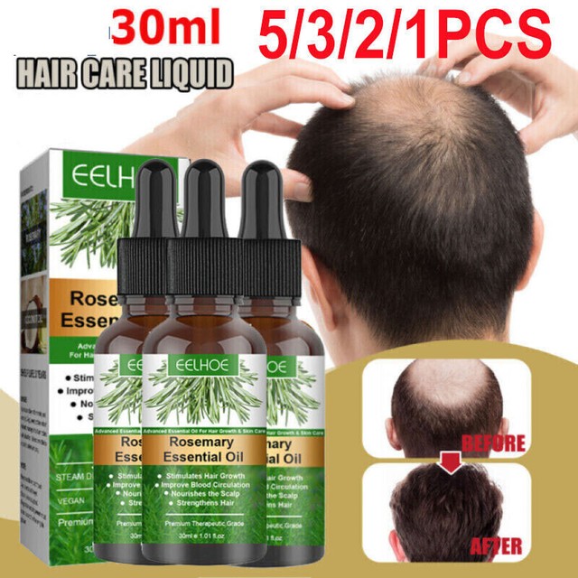 5/3X Rosemary Hair Growth Oil Skin Care Nourishment Scalp Stimulates Hair Growth 5/3X Rosemary Hair Growth Oil Skin Care Nourishment Scalp Stimulates Hair Growth