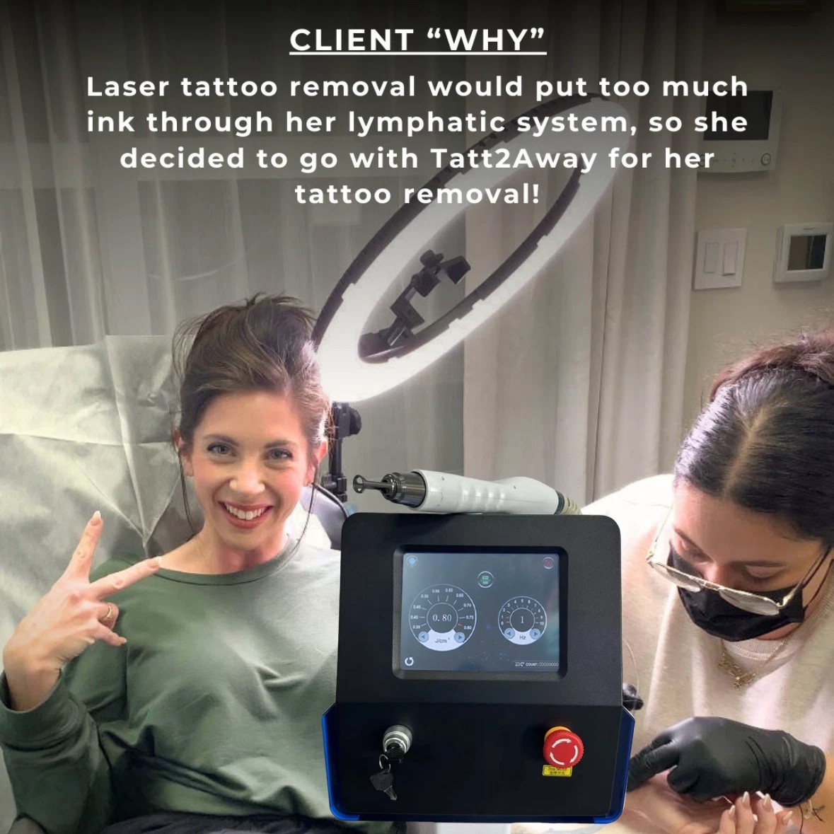 Máquina láser Picosegundo Q-Switch ND Yag Máquina láser Pico láser máquina de eliminación de tatuajes