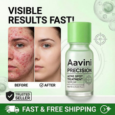 Acne Spot Treatment Serum 10ml Overnight Pimple Care, Oil Control Blemish Relief